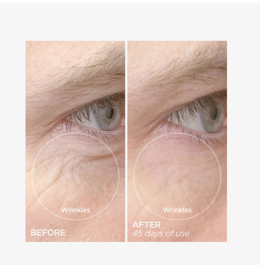 BeautyBio Retinol Boost (6 x 0.17 fl. oz. / 5 ml e)